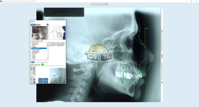 Как загрузить dicom файлы в dolphin imaging