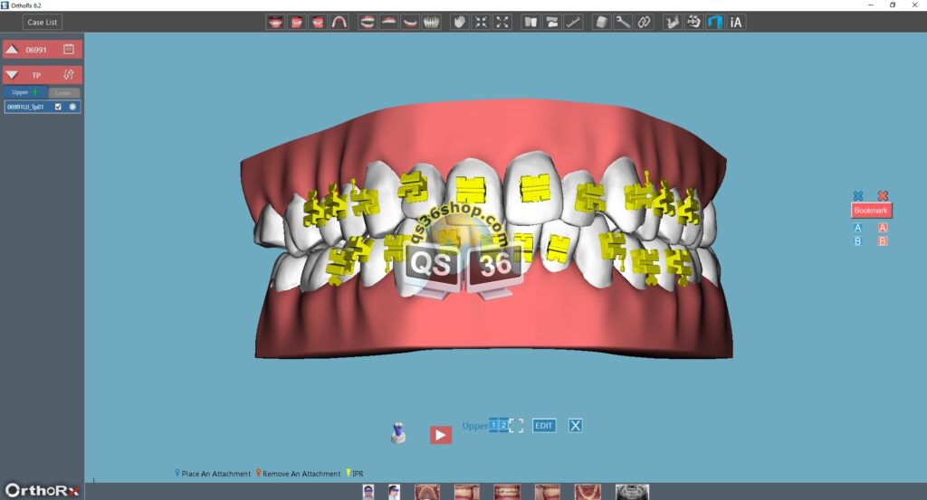 iROK OrthoRx 6.2 Full QS36 Shop